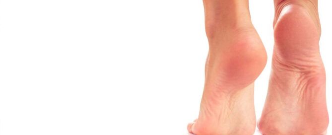 Dolore ai piedi o instabilità? Il piede cavo può influenzare il tuo equilibrio. Scopri le soluzioni più efficaci per alleviare i sintomi e migliorare la postura.