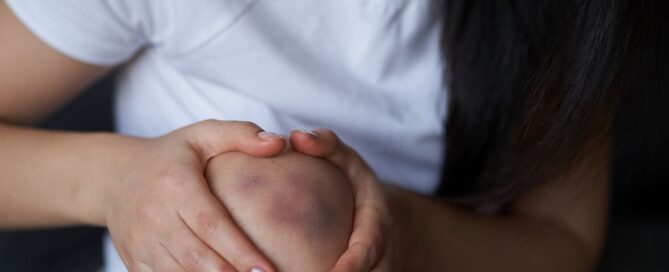 Contusione muscolare: cosa fare, tempi di recupero e fisioterapia a Palermo