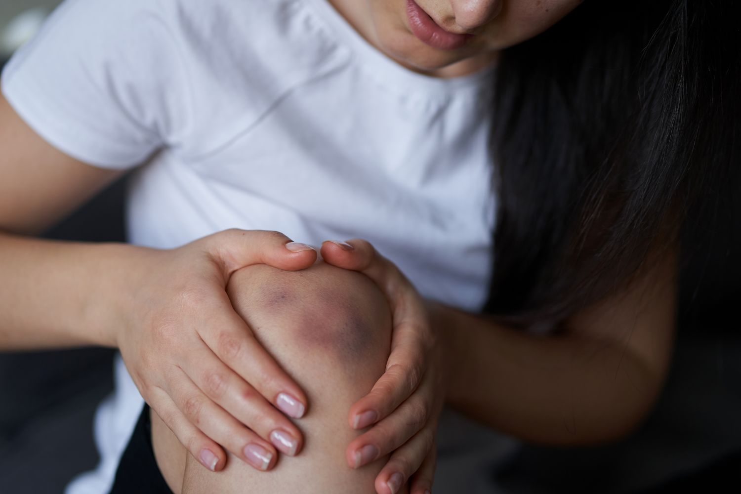 Contusione: cause, sintomi, rimedi e fisioterapia per una guarigione efficace Contusione muscolare: cosa fare, tempi di recupero e fisioterapia a Palermo